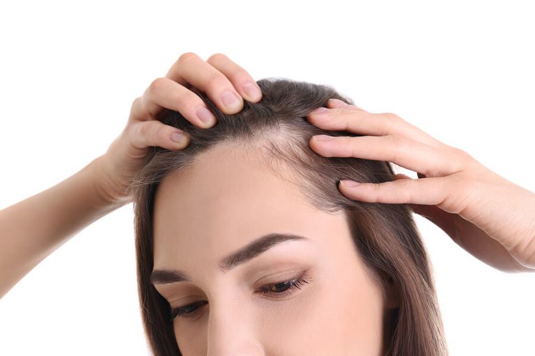 Treatments For Female Hair Loss: Boost Your Hair Growth