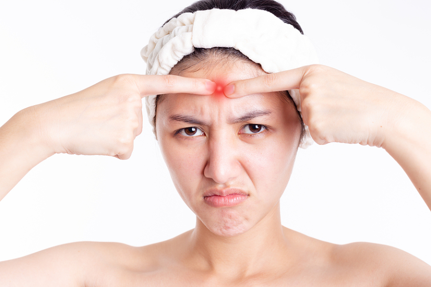 3 Vital Things You Can Do To Manage An Acne-Prone T-Zone