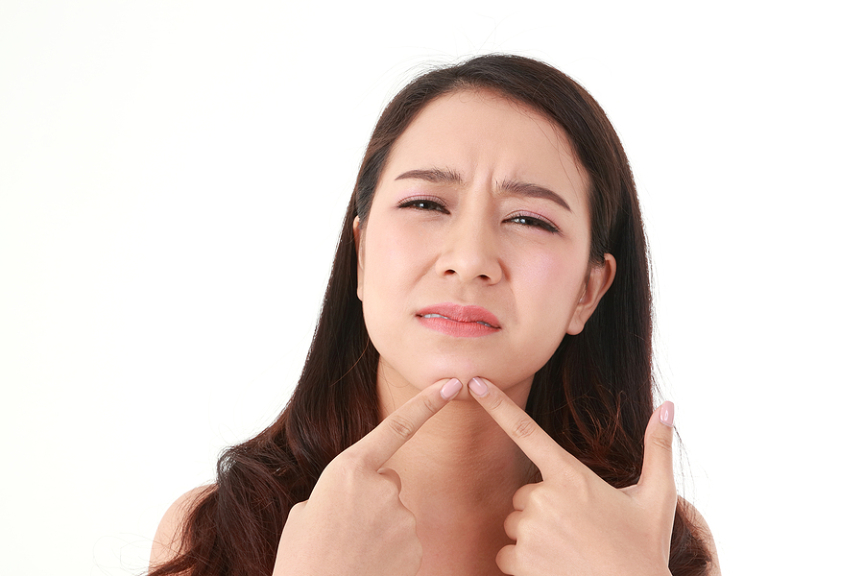 Acne Affects More Than Your Skin: Its Impact On Mental Health