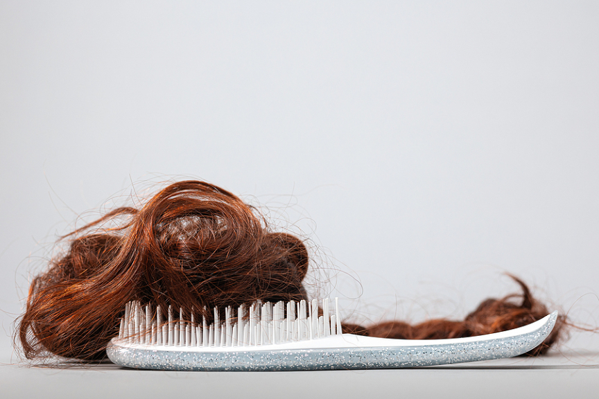 Are Hair Transplants Worth It? Do They Really Work?