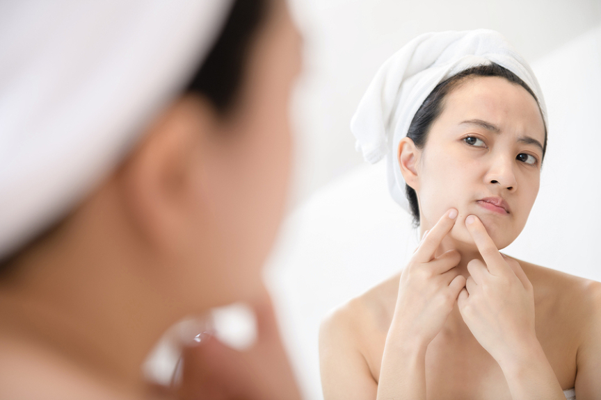 All About Pimple Popping: Is It Really Bad For Your Skin?