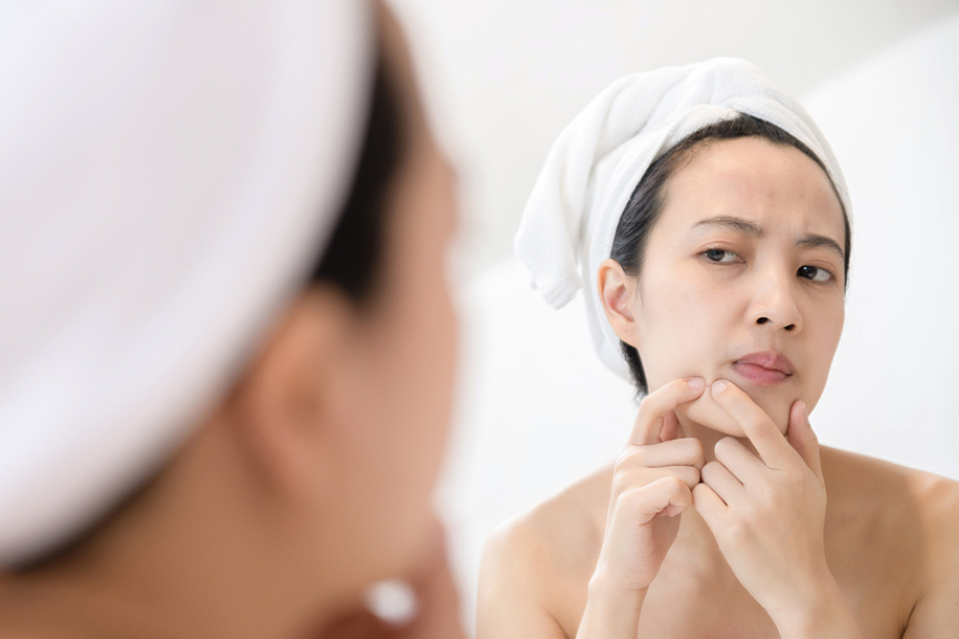 Why Your Makeup Could Be Causing Your Acne Breakouts
