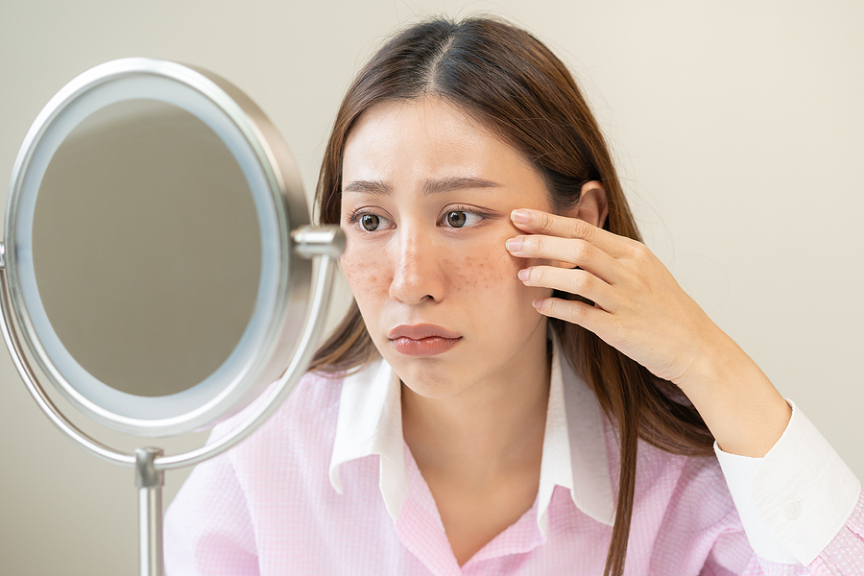 Unmasking Unlikely Culprits: Surprising Causes Of Pigmentation