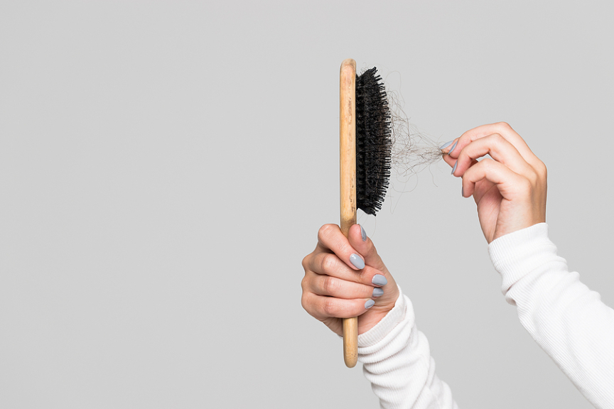 Unraveling The Ties Between Hormonal Imbalance And Hair Loss