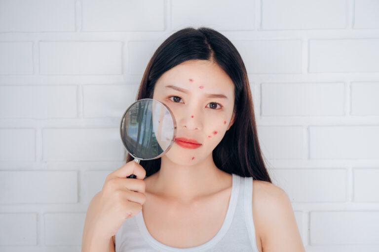 Ear Acne Prevention In Hot And Humid Weather photo