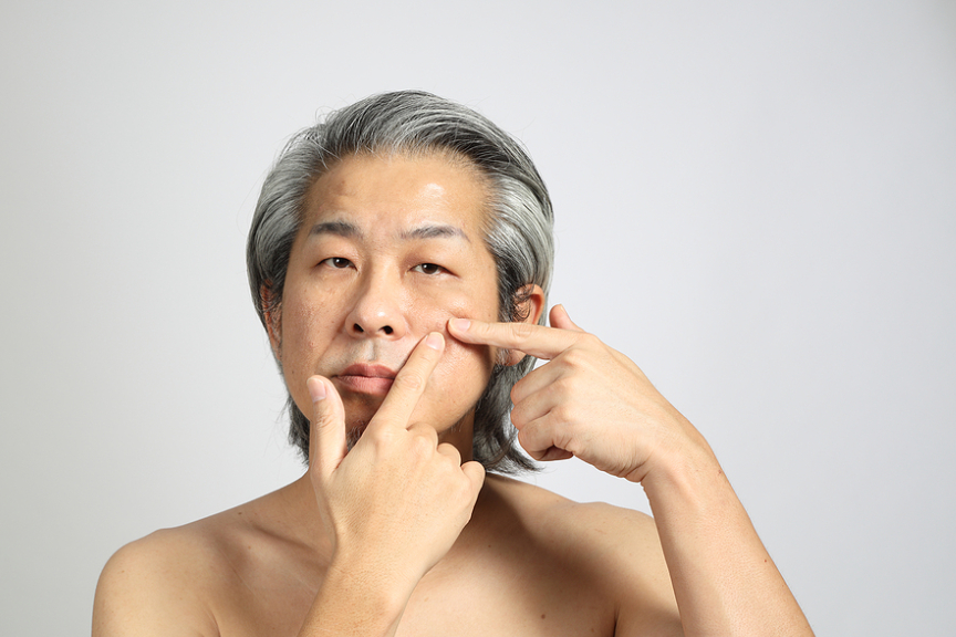 Breaking Out Isn’t Just for Teens: Tackling Adult Acne in Dads