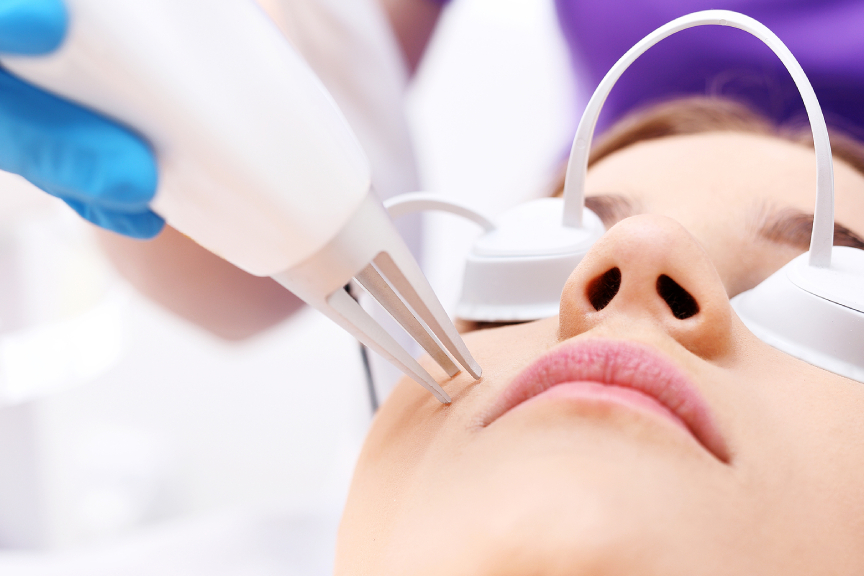 Getting Lasers for Scars? Read This Before You Book