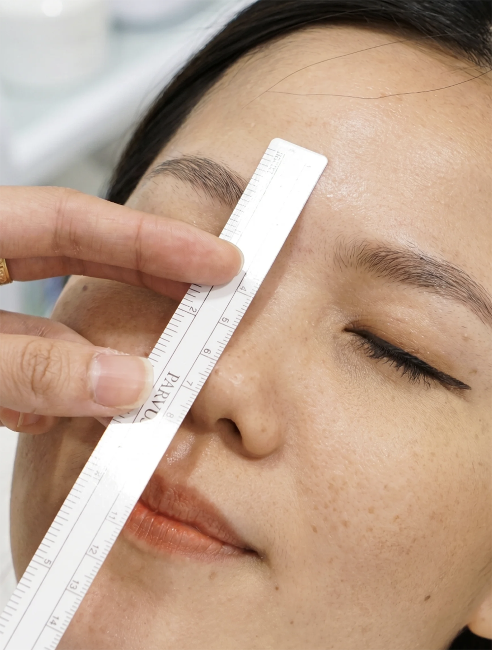Nose Thread Lift Singapore