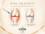 Hyaluronic Acid Knee Injections (Viscosupplementation): A Patient’s ...