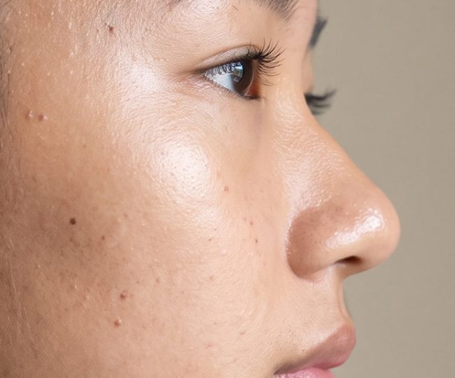nose side profile
