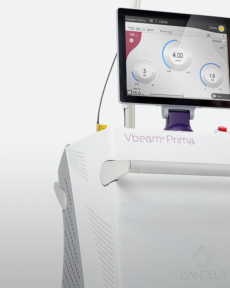 vbeam singapore